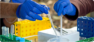 Supply and Dosing of Enzymes